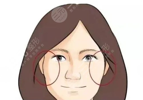 成都李继华磨骨怎么样?