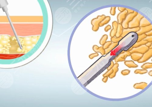 北京上上相医疗美容诊所怎么样?