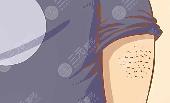 鸡皮疙瘩皮肤怎么治比较好?