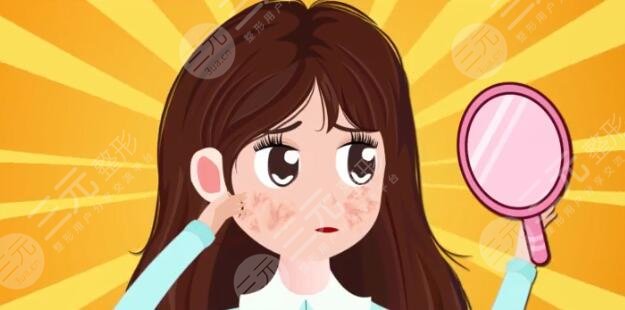 激光嫩肤一般多少钱做一次?