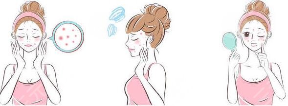 激光缓解鼻子痤疮要多少钱?