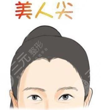 美人尖