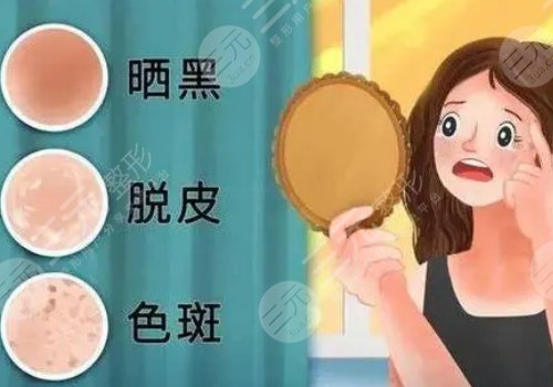 脸上的色斑怎么去掉(淡化)？