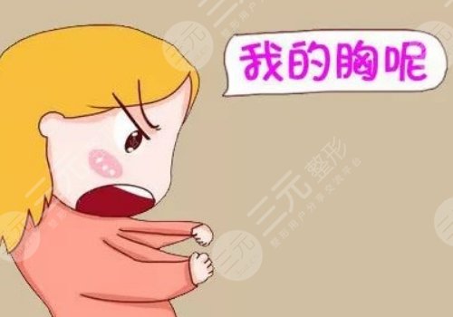 傲若拉假体怎么样?