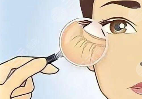 眼周抗衰综合多少钱做一次？