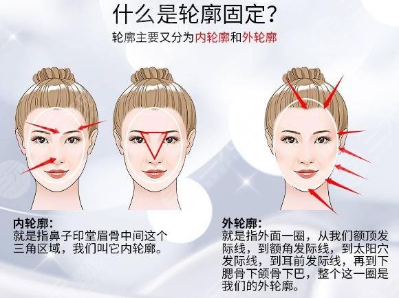 分层抗衰