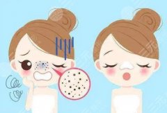 美白祛痘的方法有哪些？3种医美项目，助你修复美肌！