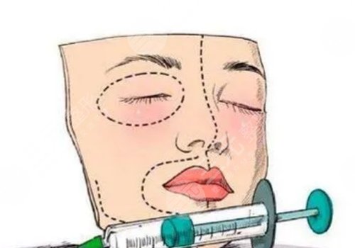 崔昌墉自体脂肪填充怎么样?