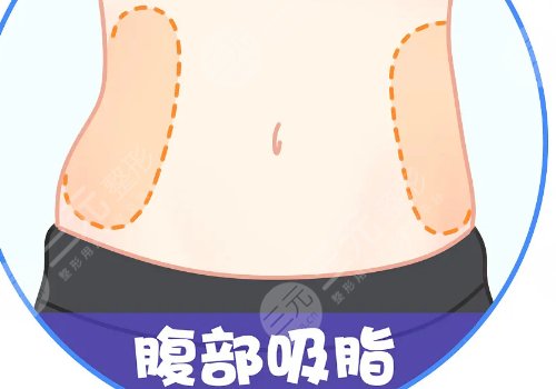 崔昌墉自体脂肪填充怎么样?