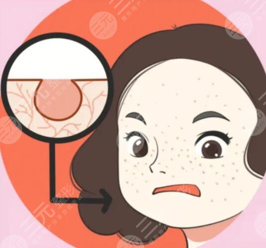 怎样收缩脸部毛孔粗大的方法,光子嫩肤是好的项目选择!