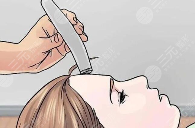 光子嫩肤后有哪些注意事项?