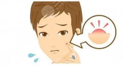 缓解青春痘费用多少钱？哪些医美方法见效快？