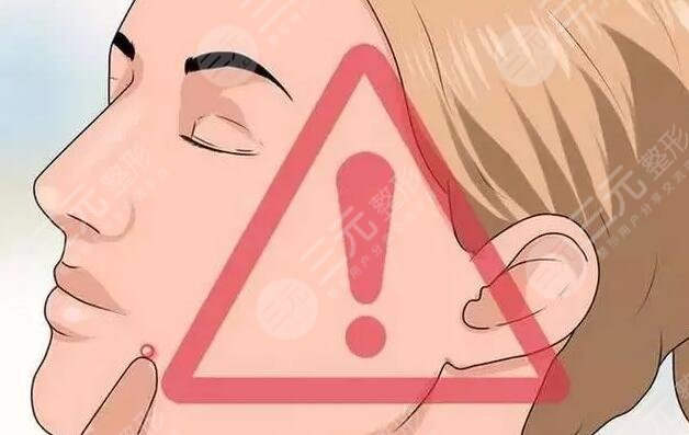 红蓝光祛痘注意事项有哪些?