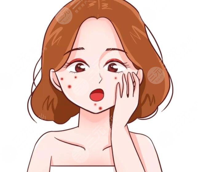 红蓝光缓解青春痘一次可以吗?