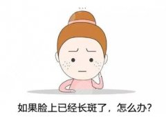 色斑如何去除？脸上“长斑”别瞎治，教你5招！