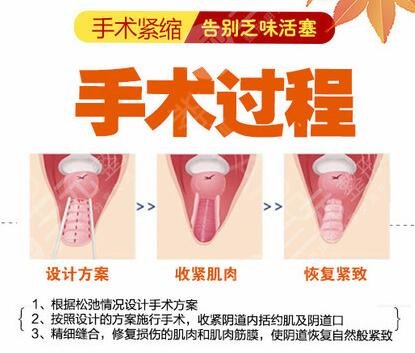 私密紧缩