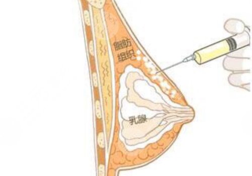 天津河西维美医疗美容医院隆医生介绍
