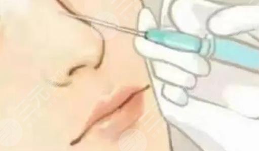 玻尿酸隆鼻价格是多少