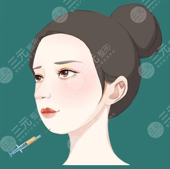 玻尿酸隆鼻价格是多少
