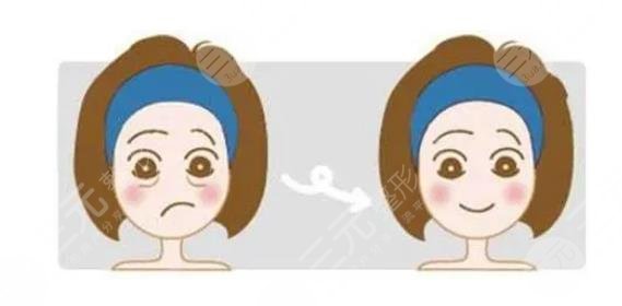 抽脂去眼袋会反弹吗