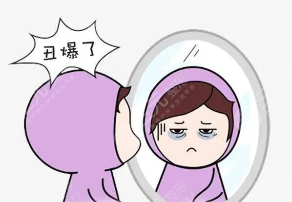 怎样能够帮助减轻黑眼圈呢?