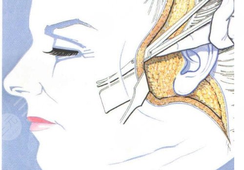 多维除皱真的有用吗？