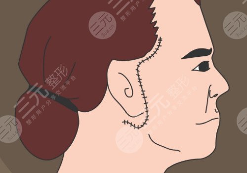 多维除皱真的有用吗？