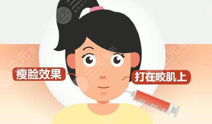 注射瘦脸