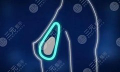 德国宝俪与美国曼托哪一个贵？原理、优势、价格对比