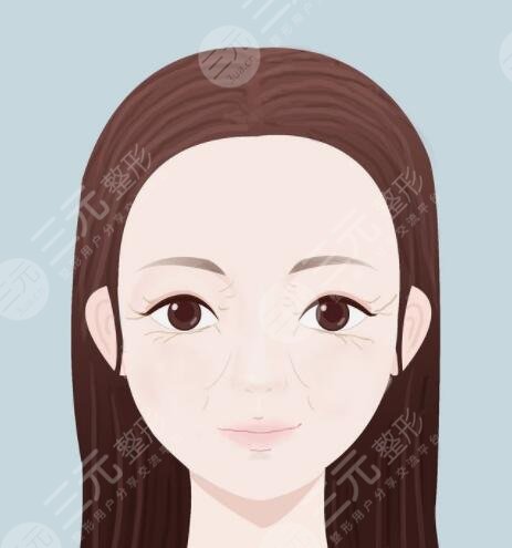 做了筋膜重整能够维持多长时间?