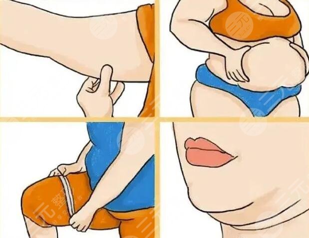 光纤溶脂是怎么做的?