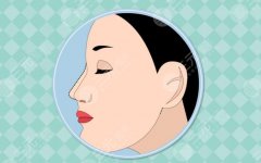 玻尿酸隆鼻注意事项有哪些？危害和后遗症怎么避免？鼻整形专家科普