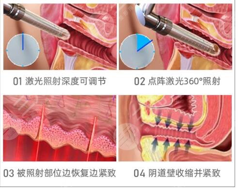 女人私密紧致产品可以用吗?