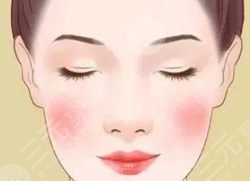 红血丝激光多少钱