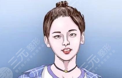 额头窄丰额头价格是多少