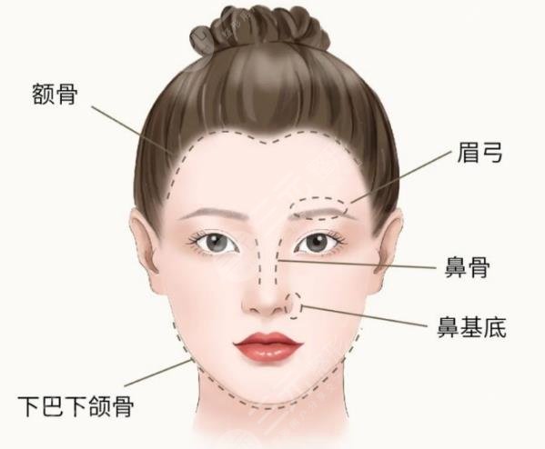 所谓的骨相塑形是对整个面部的骨骼组织进行相应的改良,通常情况下