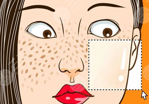 激光祛斑后反黑怎样能快速消除？