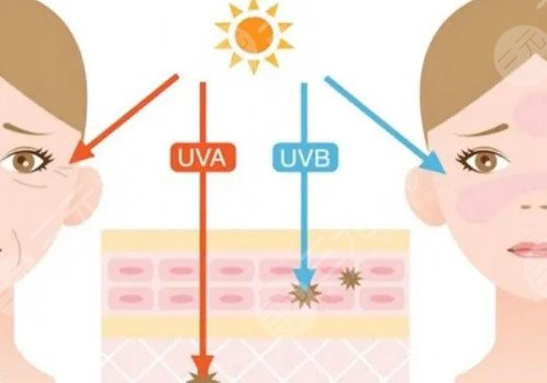 射频除皱能维持多久？多久看到效果？