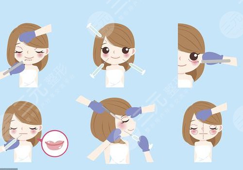 西安美莱曾熬面部填充怎么样?