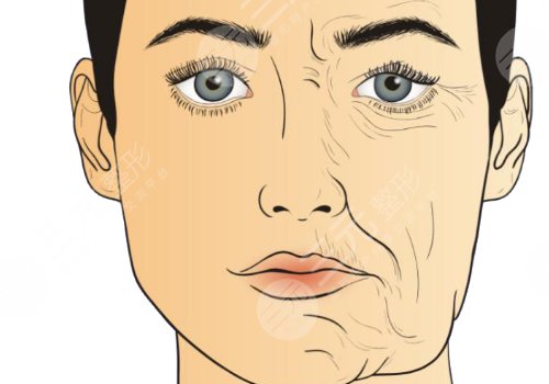 深蓝射频间隔多久做一次？