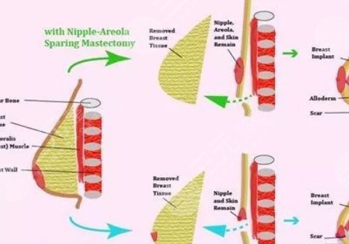 王爱武整形医师医术怎么样？