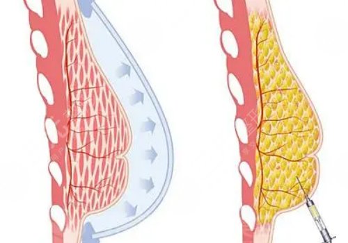 王爱武整形医师医术怎么样？