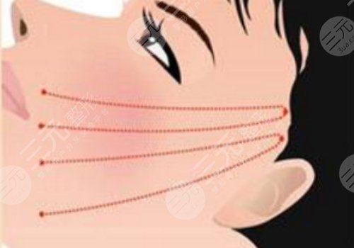 北京黄寺医疗美容诊所做拉皮手术好吗?