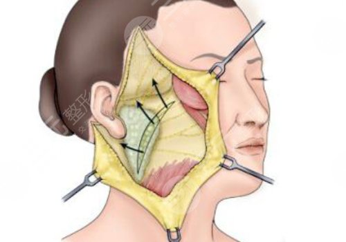 柳民熙医生坐诊医院