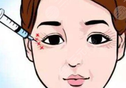注射除皱眼部效果好吗?