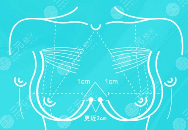 极速丰胸靠谱吗?