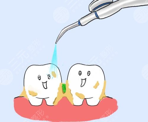 冷光美白牙齿好吗?