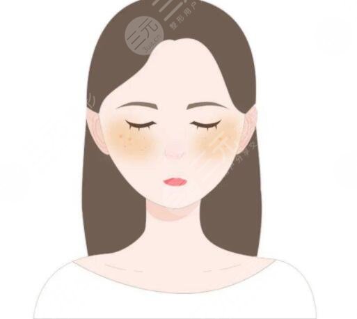 去除黄褐斑价格大概是多少？哪种方式祛斑见效快！