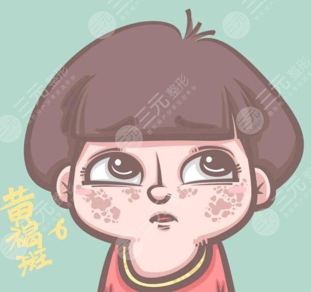 医美激光祛除黄褐斑原理是什么?