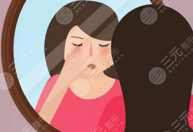 去除黄褐斑价格大概是多少?